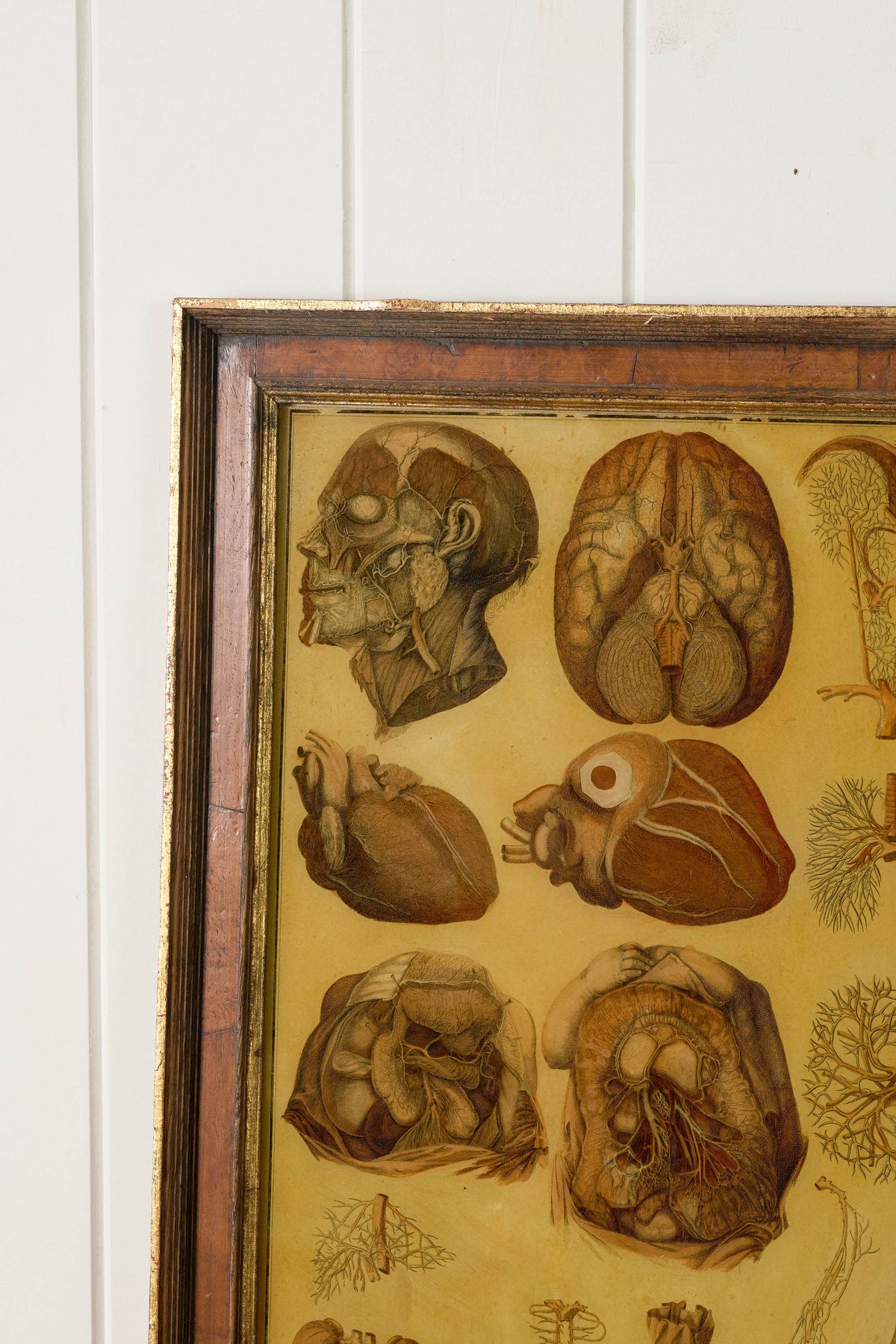 Early 20th Century English School Anatomy Prints with Walnut Frames + Inner Gilt